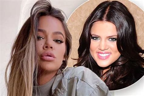 Khloe Kardashian Confirms Nose Job & Injections In .